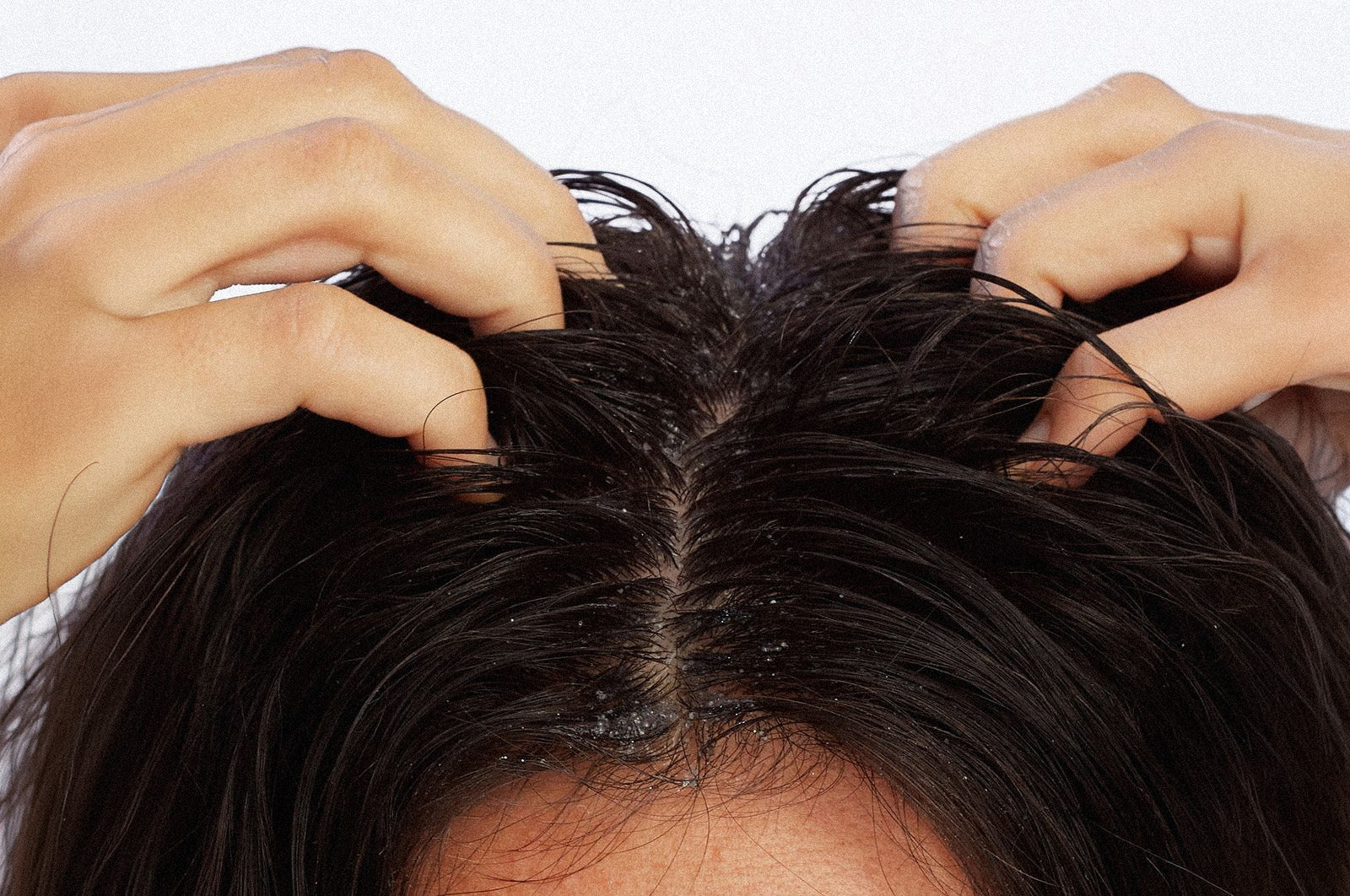 Is Your Scalp Sabotaging Your Shine?